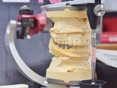 STEP5　修復プログラム